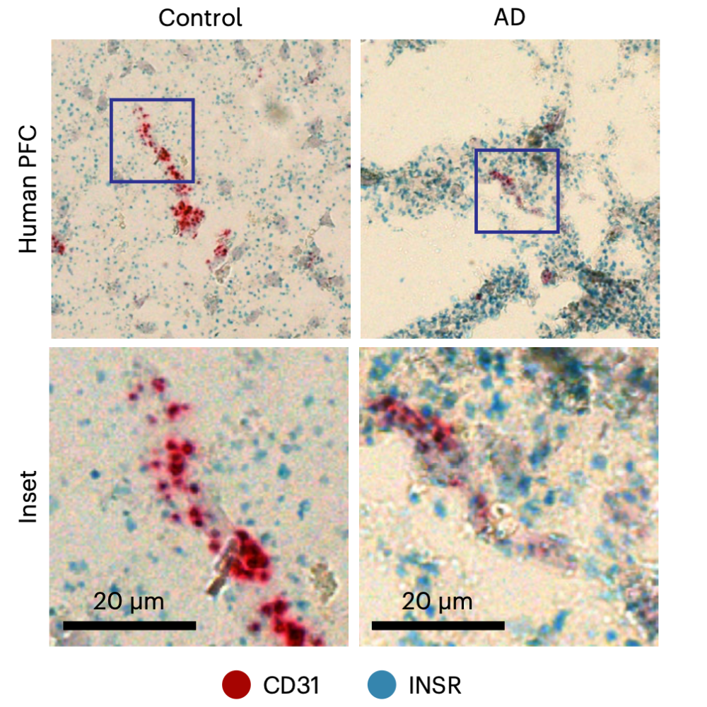 Sun_NatureNeuroscience_23